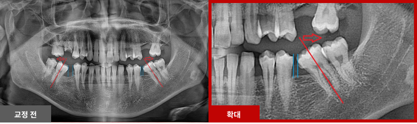 스케일링